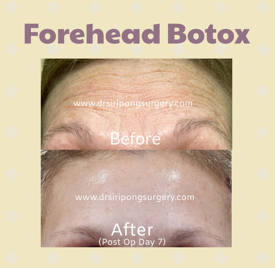 Dr Siripong Surgery - Dr Siripong Surgery