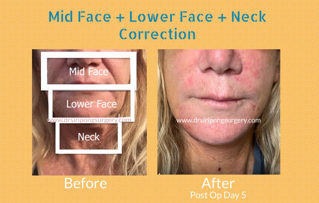 Dr Siripong Surgery - Dr Siripong Surgery