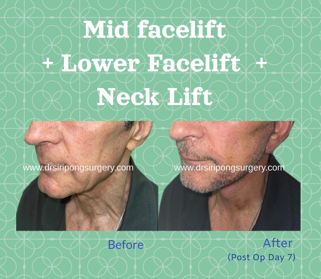 Dr Siripong Surgery - Dr Siripong Surgery