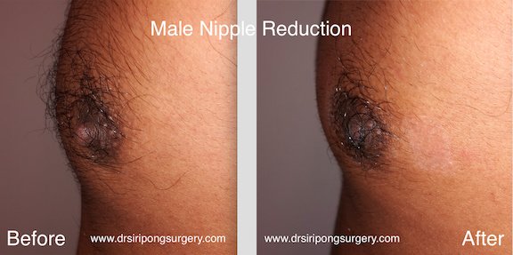 Dr Siripong Surgery - Dr Siripong Surgery