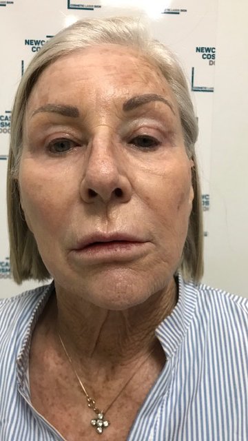 Dr Siripong Surgery - Dr Siripong Surgery