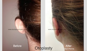 Dr Siripong Surgery - Dr Siripong Surgery