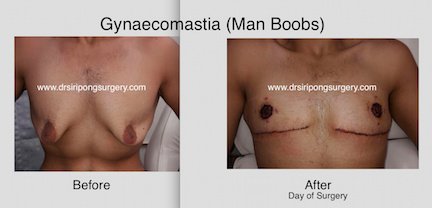 Dr Siripong Surgery - Dr Siripong Surgery