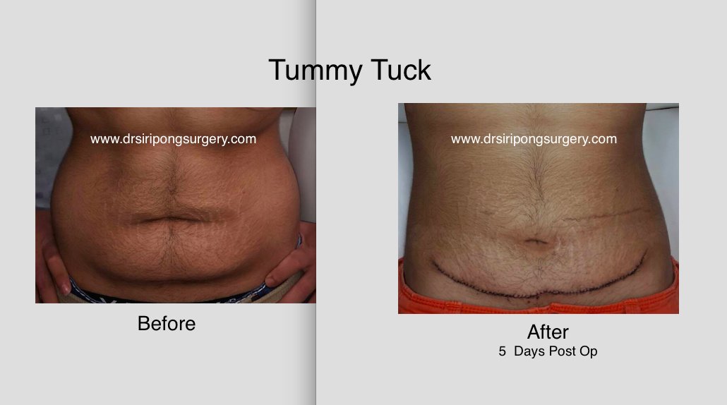 Dr Siripong Surgery - Dr Siripong Surgery