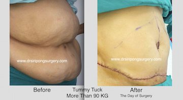 Dr Siripong Surgery - Dr Siripong Surgery