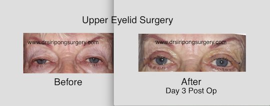 Dr Siripong Surgery - Dr Siripong Surgery