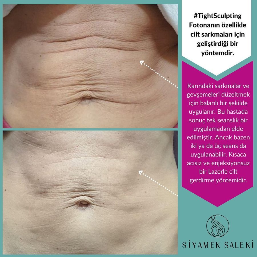 Dr Siyamek Saleki Esthetics - Dr Siyamek Saleki Esthetics