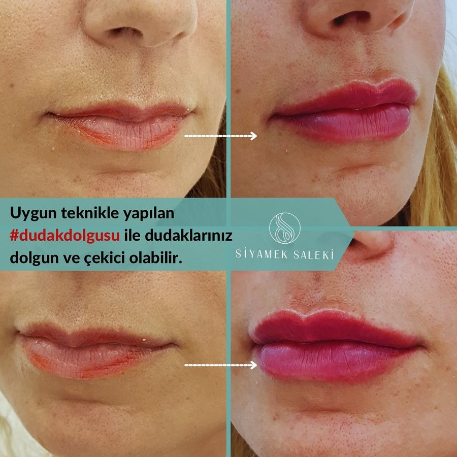 Dr Siyamek Saleki Esthetics - Dr Siyamek Saleki Esthetics