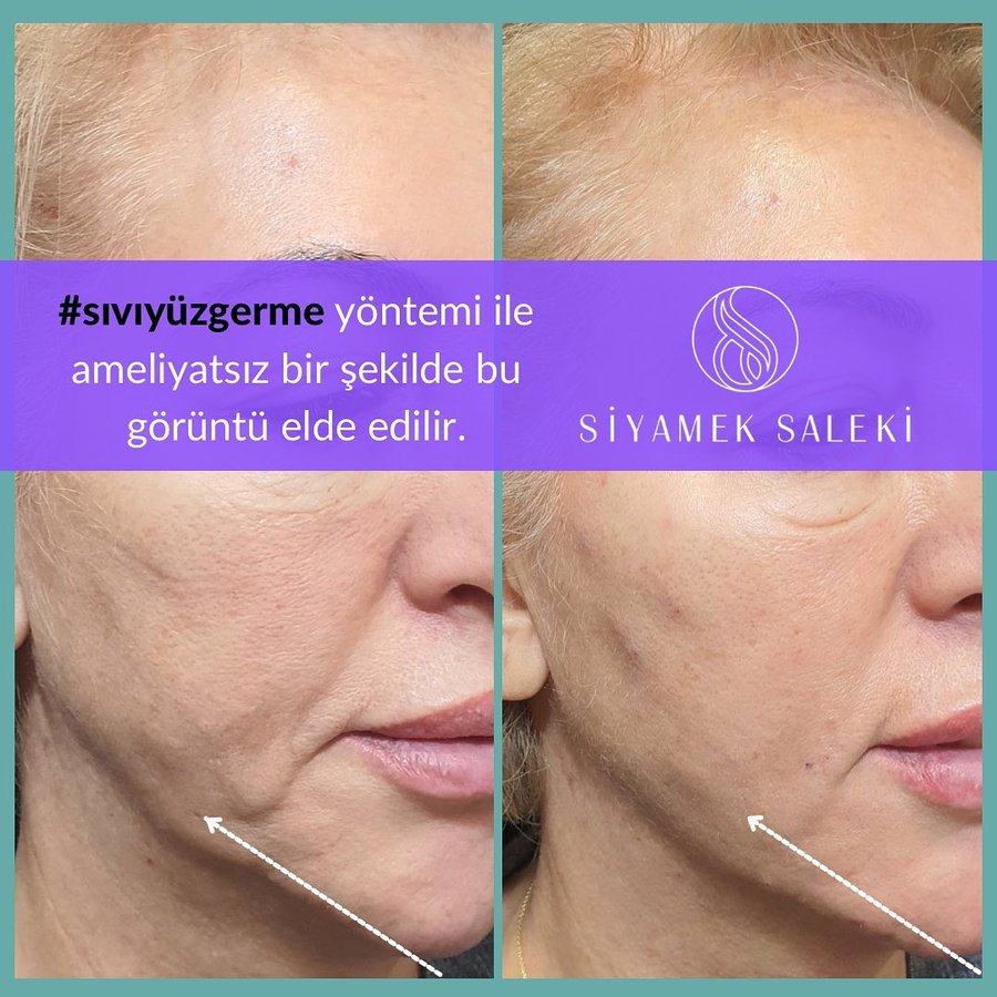 Dr Siyamek Saleki Esthetics - Dr Siyamek Saleki Esthetics