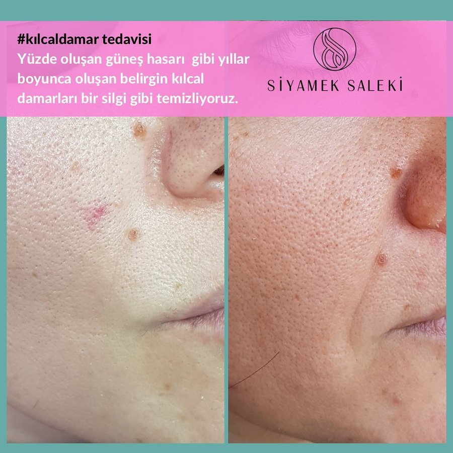 Dr Siyamek Saleki Esthetics - Dr Siyamek Saleki Esthetics