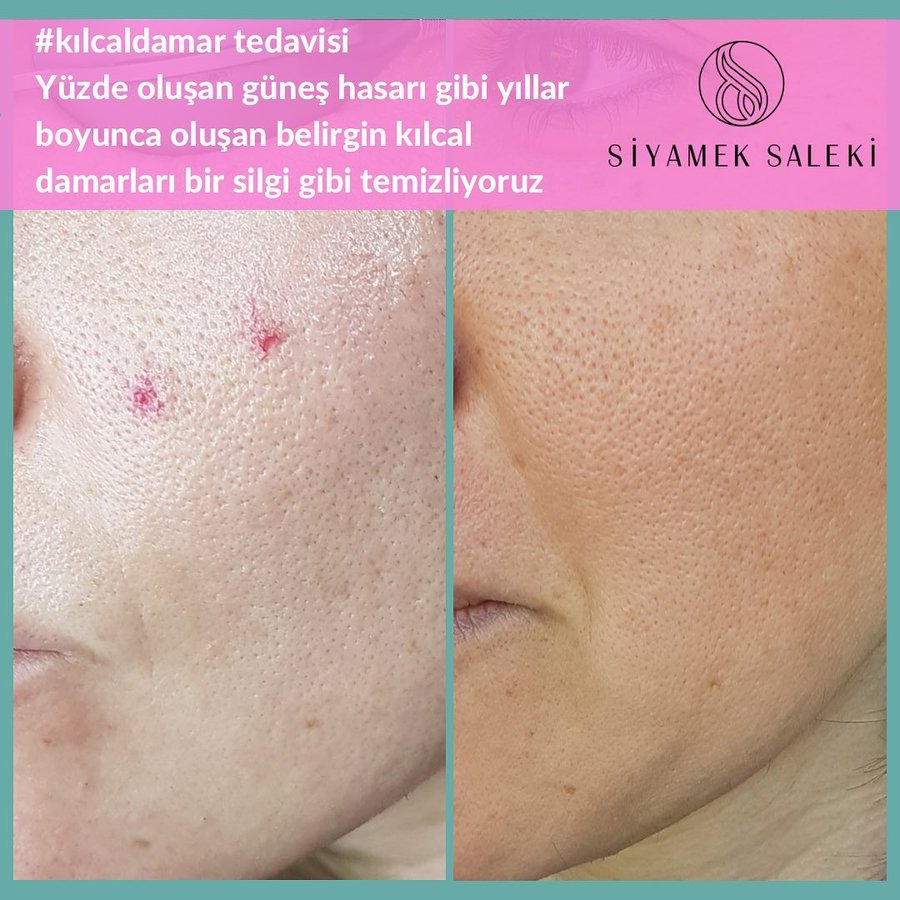Dr Siyamek Saleki Esthetics - Dr Siyamek Saleki Esthetics