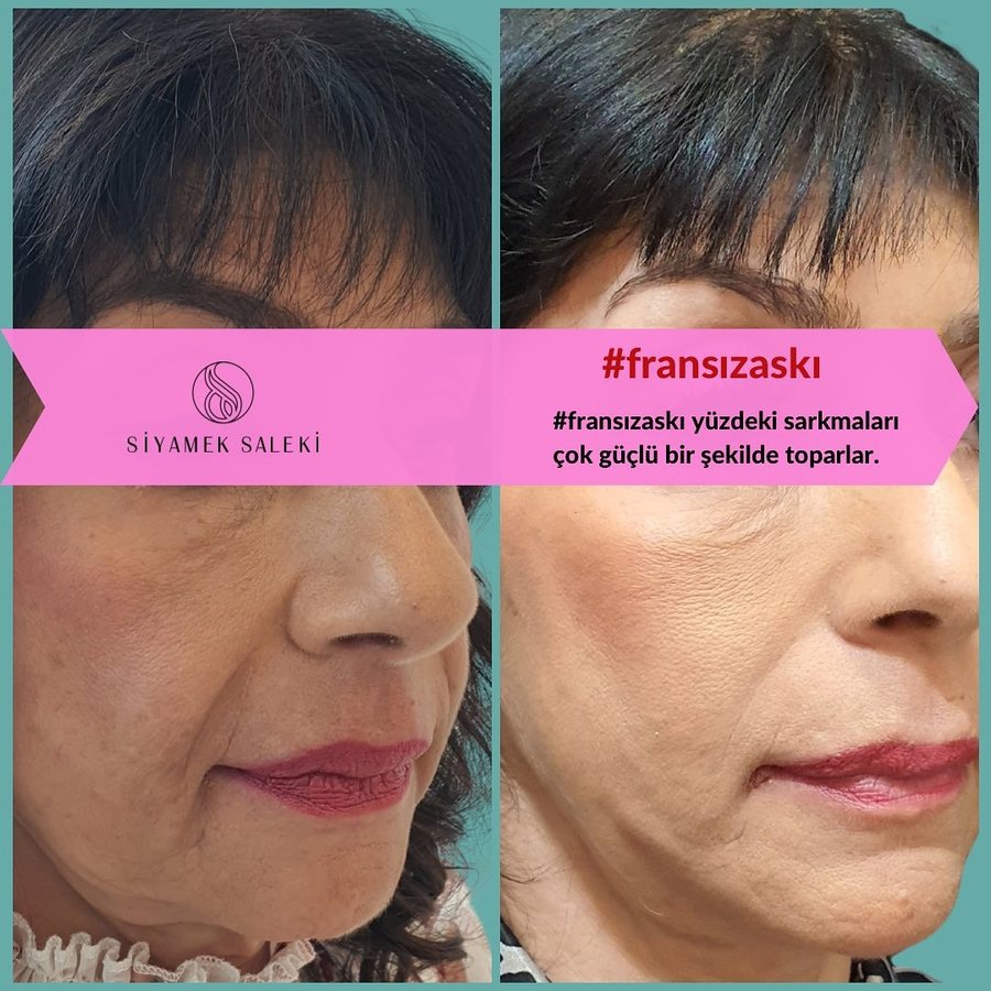 Dr Siyamek Saleki Esthetics - Dr Siyamek Saleki Esthetics