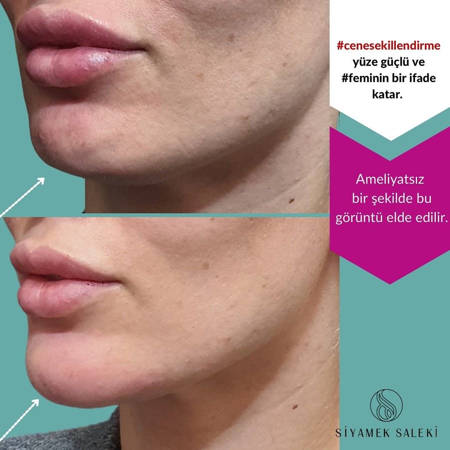 Dr Siyamek Saleki Esthetics - Dr Siyamek Saleki Esthetics