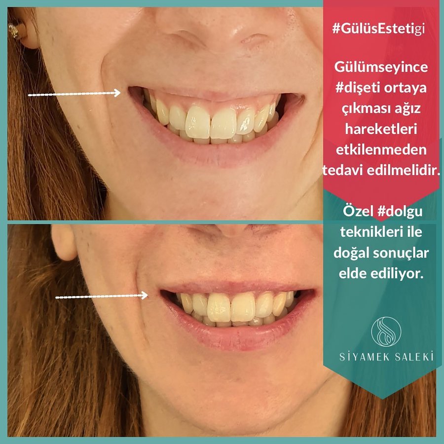 Dr Siyamek Saleki Esthetics - Dr Siyamek Saleki Esthetics