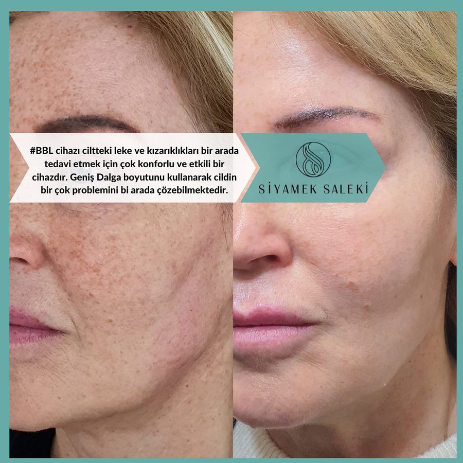 Dr Siyamek Saleki Esthetics - Dr Siyamek Saleki Esthetics