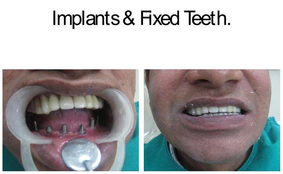 Dr Sridhar International Dental Hospitals - Dr Sridhar International Dental Hospitals