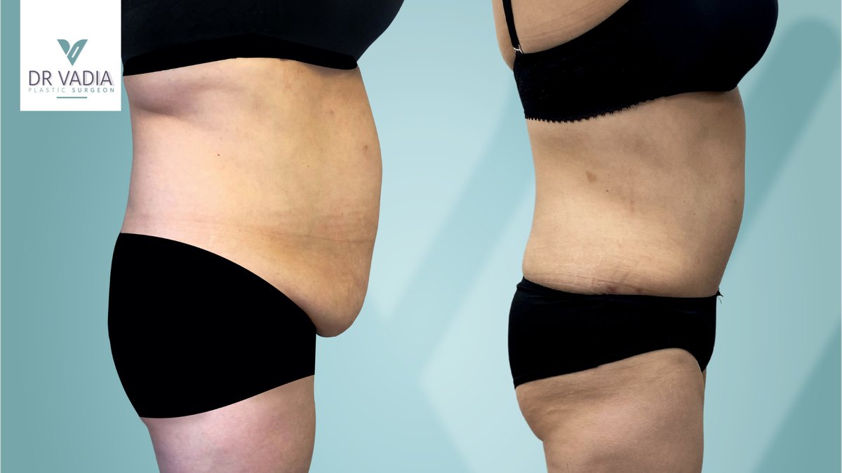 Dr. Suleman Vadia - Dr. Suleman Vadia