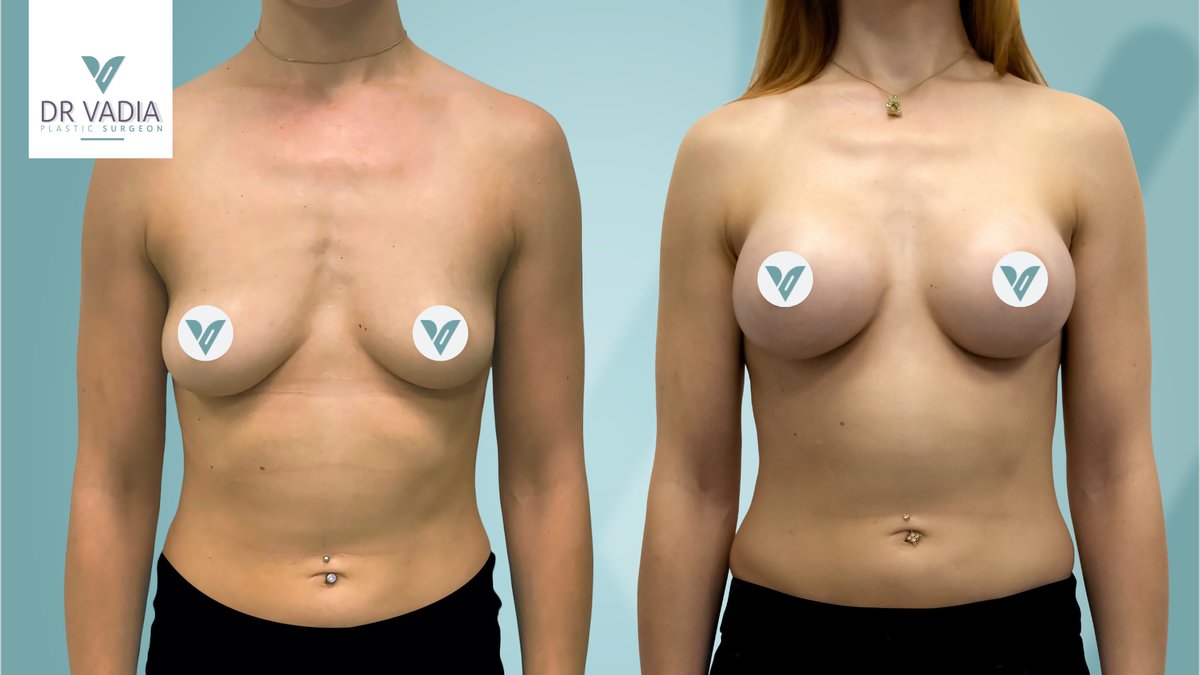 Dr. Suleman Vadia - Dr. Suleman Vadia