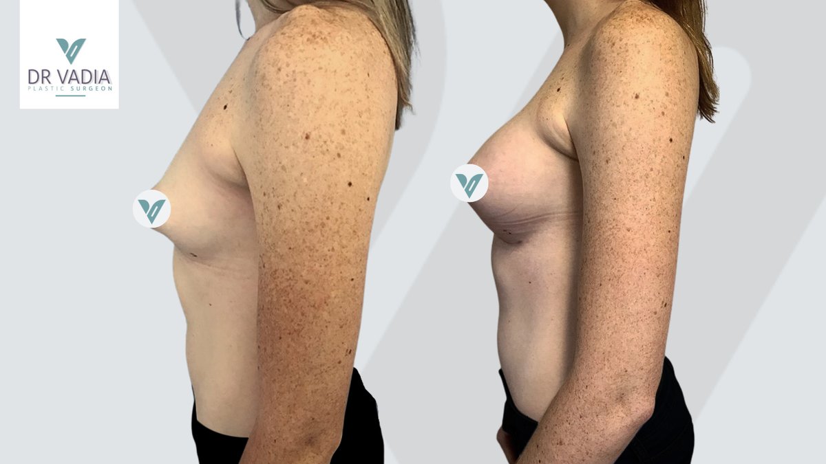 Dr. Suleman Vadia - Dr. Suleman Vadia