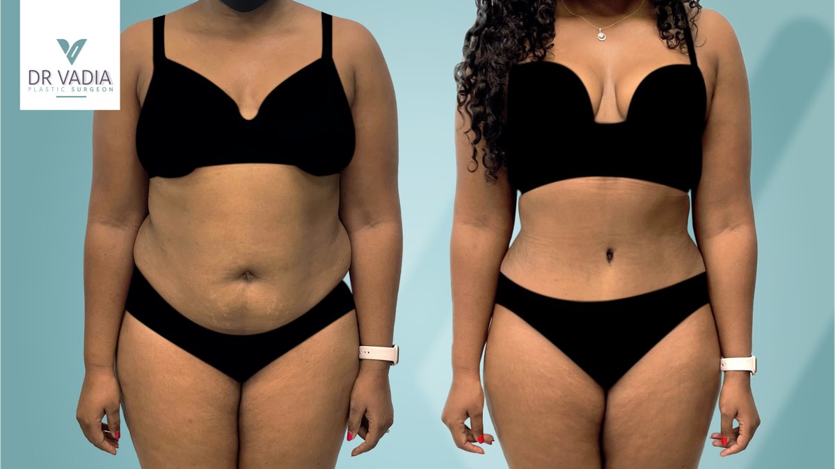 Dr. Suleman Vadia - Dr. Suleman Vadia