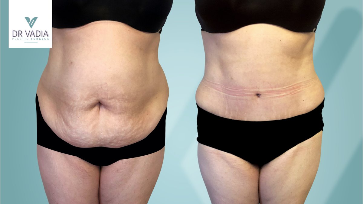 Dr. Suleman Vadia - Dr. Suleman Vadia