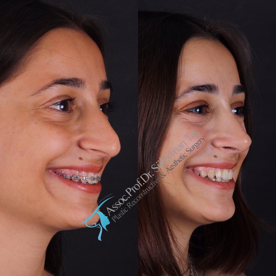 Dr. Suleyman Tas MD, Aesthetic and Plastic Surgeon - Dr. Suleyman Tas MD, Aesthetic and Plastic Surgeon