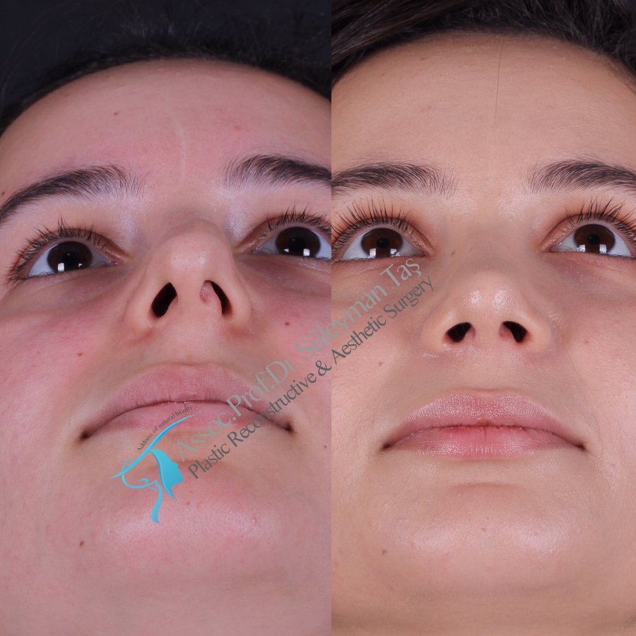 Dr. Suleyman Tas MD, Aesthetic and Plastic Surgeon - Dr. Suleyman Tas MD, Aesthetic and Plastic Surgeon