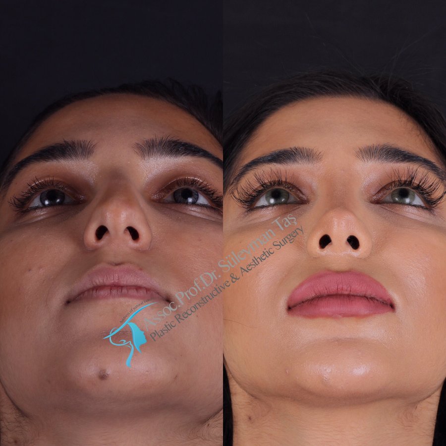 Dr. Suleyman Tas MD, Aesthetic and Plastic Surgeon - Dr. Suleyman Tas MD, Aesthetic and Plastic Surgeon