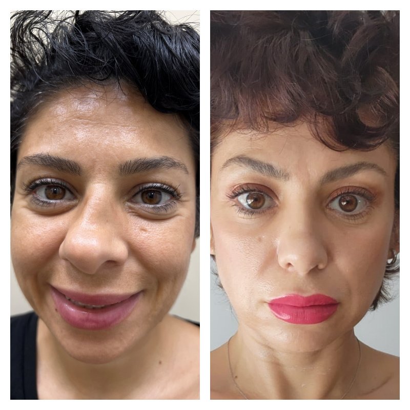 Dr. Suleyman Tas MD, Aesthetic and Plastic Surgeon - Dr. Suleyman Tas MD, Aesthetic and Plastic Surgeon