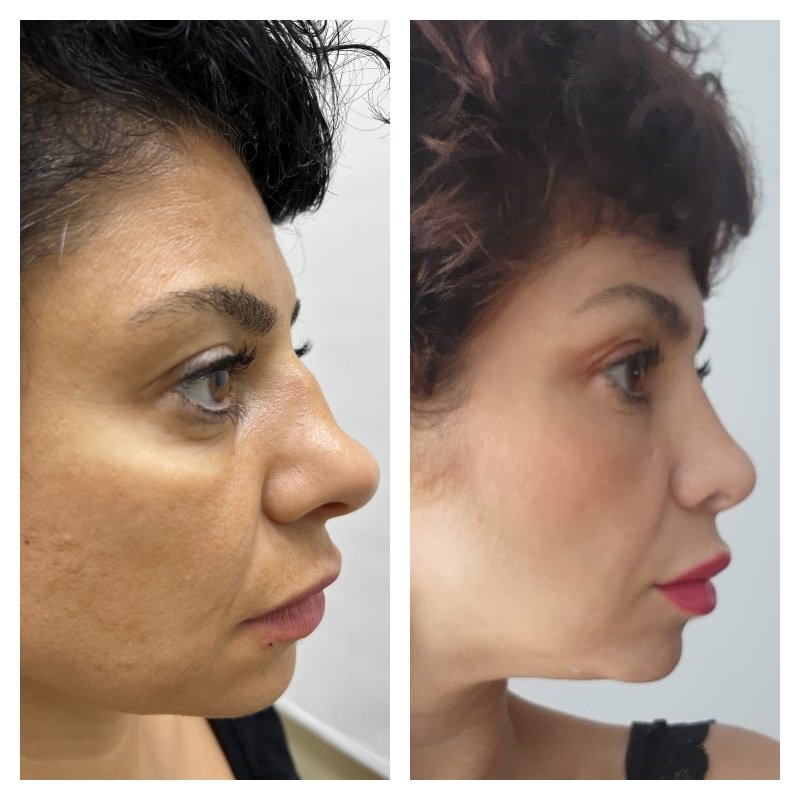 Dr. Suleyman Tas MD, Aesthetic and Plastic Surgeon - Dr. Suleyman Tas MD, Aesthetic and Plastic Surgeon