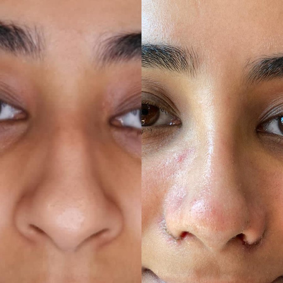 Dr. Suleyman Tas MD, Aesthetic and Plastic Surgeon - Dr. Suleyman Tas MD, Aesthetic and Plastic Surgeon