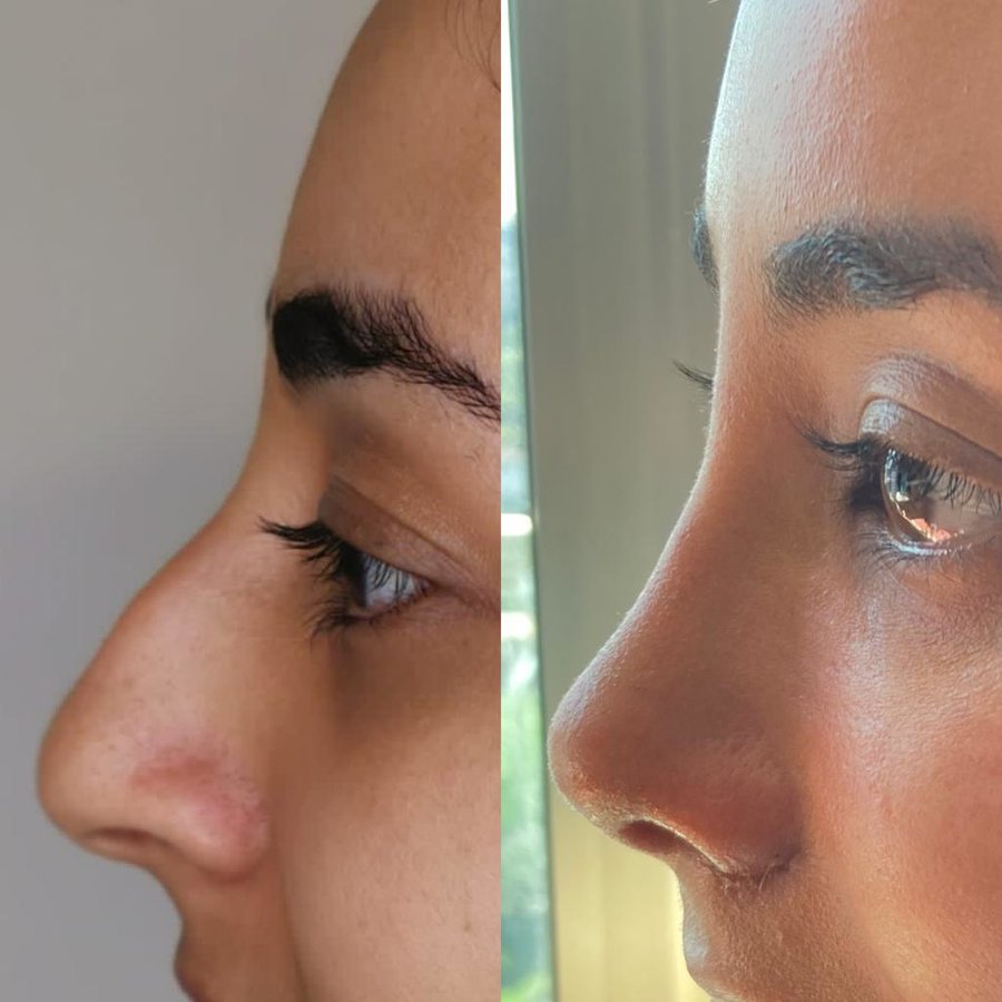 Dr. Suleyman Tas MD, Aesthetic and Plastic Surgeon - Dr. Suleyman Tas MD, Aesthetic and Plastic Surgeon