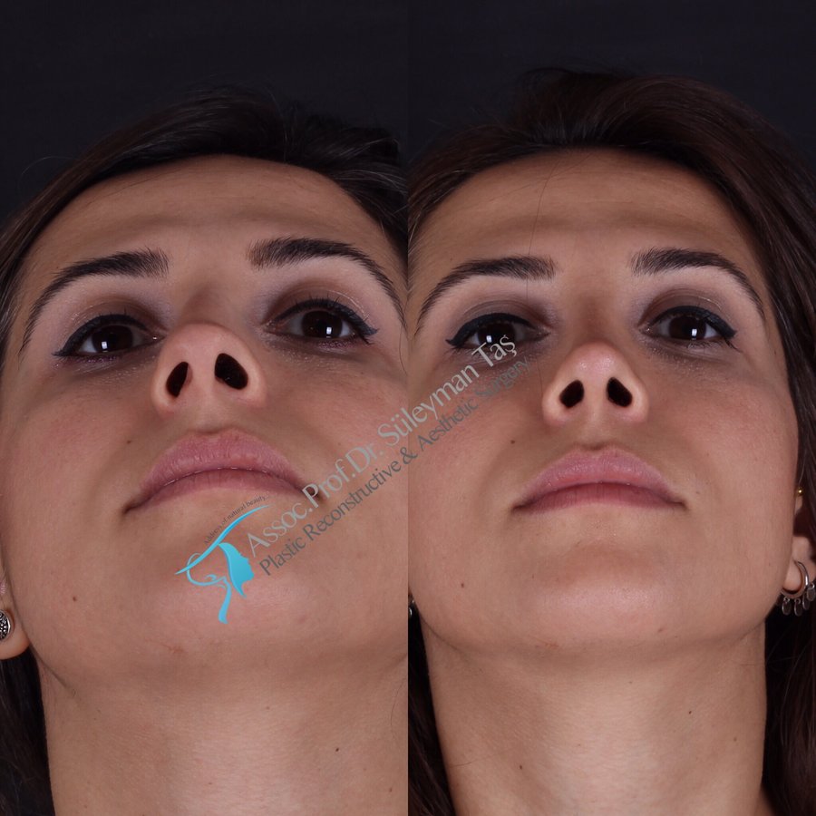 Dr. Suleyman Tas MD, Aesthetic and Plastic Surgeon - Dr. Suleyman Tas MD, Aesthetic and Plastic Surgeon