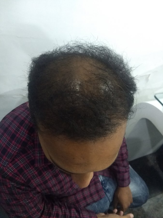dr sumayya dermacare skin clinic - dr sumayya dermacare skin clinic
