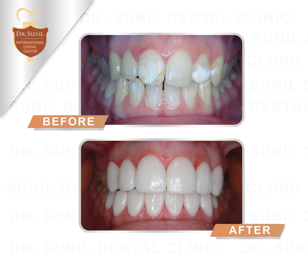 Dr. Sunil Dental Clinic - Dr. Sunil Dental Clinic