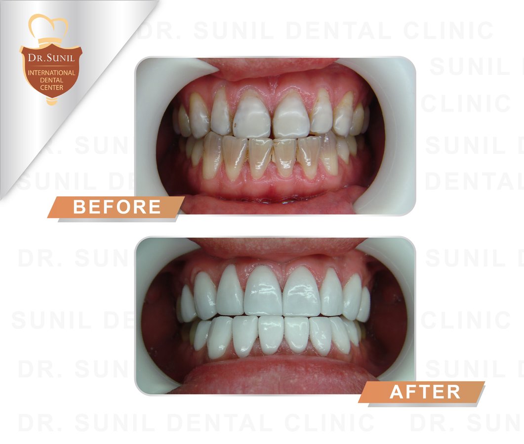 Dr. Sunil Dental Clinic - Dr. Sunil Dental Clinic