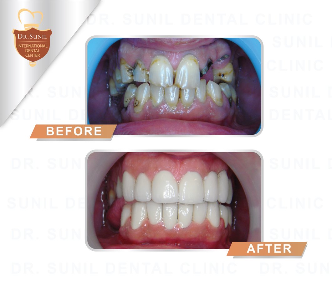 Dr. Sunil Dental Clinic - Dr. Sunil Dental Clinic