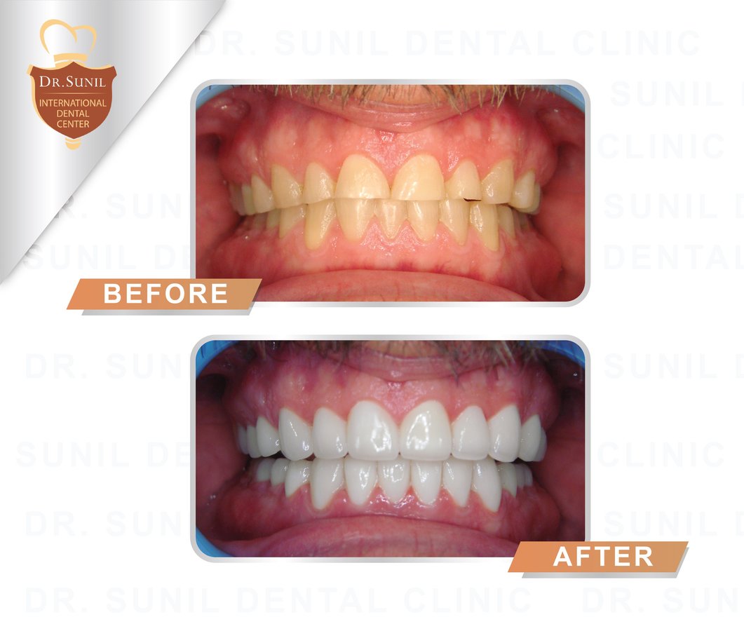 Dr. Sunil Dental Clinic - Dr. Sunil Dental Clinic