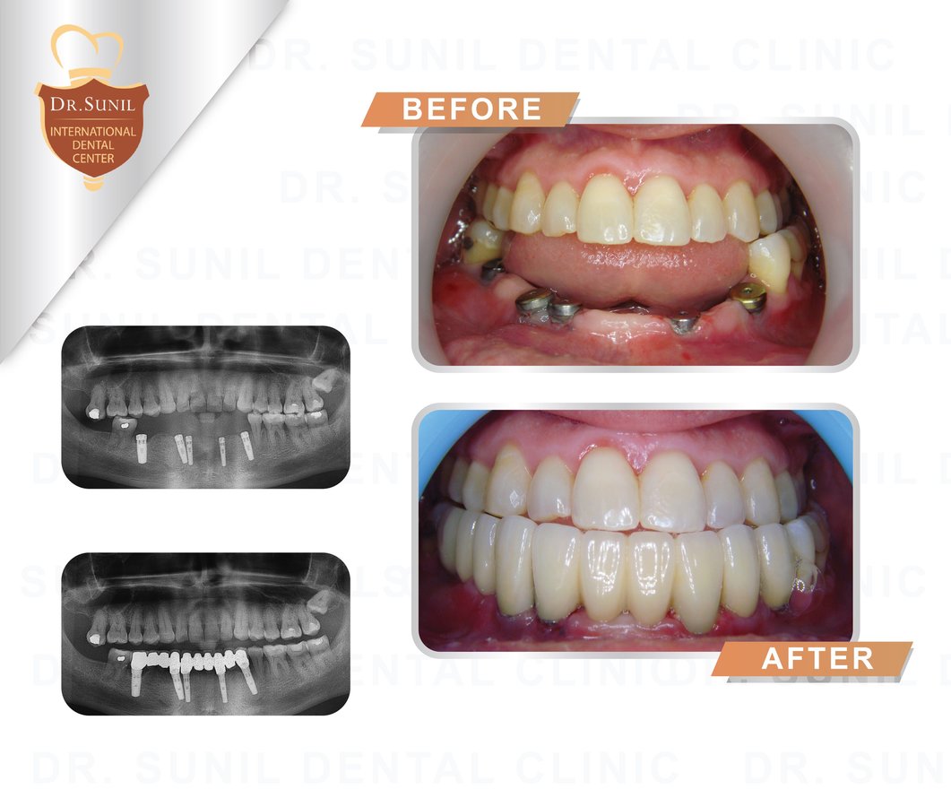 Dr. Sunil Dental Clinic - Dr. Sunil Dental Clinic