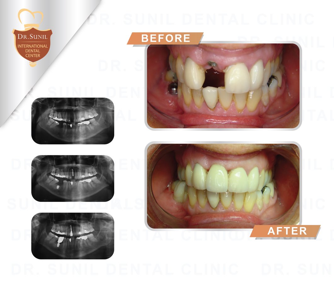 Dr. Sunil Dental Clinic - Dr. Sunil Dental Clinic