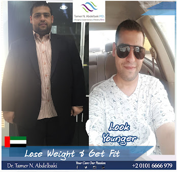 الدكتور تامر عبد الباقي - Dr. Tamer Abdelbaki