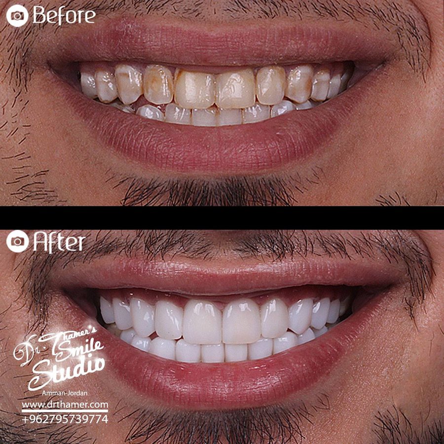 Dr. Thamer’s Smile Studio Dental Clinics - Dr. Thamer’s Smile Studio Dental Clinics