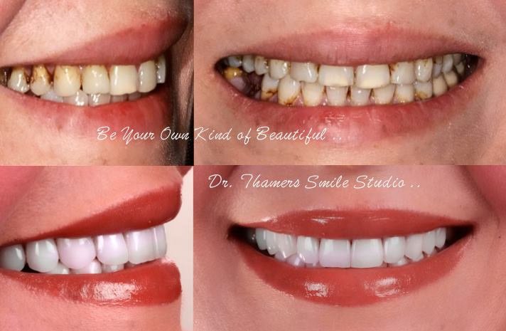 Dr. Thamer’s Smile Studio Dental Clinics - Dr. Thamer’s Smile Studio Dental Clinics