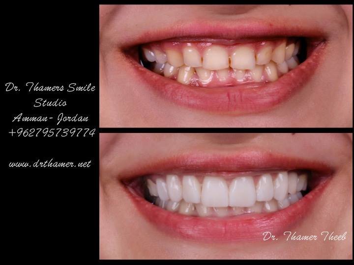 Dr. Thamer’s Smile Studio Dental Clinics - Dr. Thamer’s Smile Studio Dental Clinics