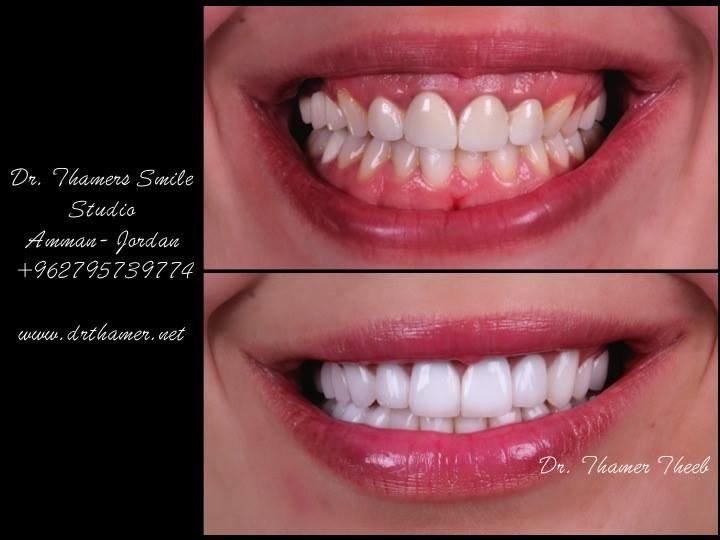 Dr. Thamer’s Smile Studio Dental Clinics - Dr. Thamer’s Smile Studio Dental Clinics