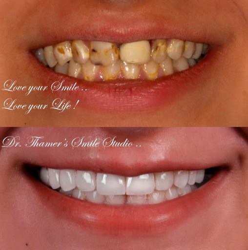 Dr. Thamer’s Smile Studio Dental Clinics - Dr. Thamer’s Smile Studio Dental Clinics