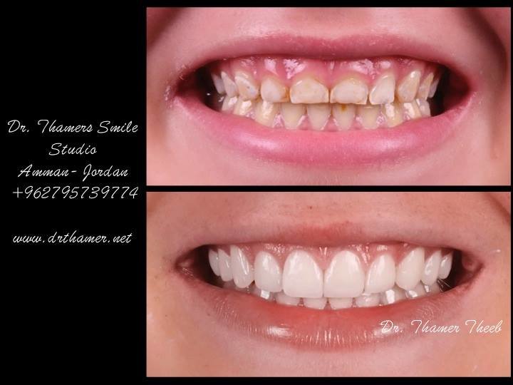 Dr. Thamer’s Smile Studio Dental Clinics - Dr. Thamer’s Smile Studio Dental Clinics