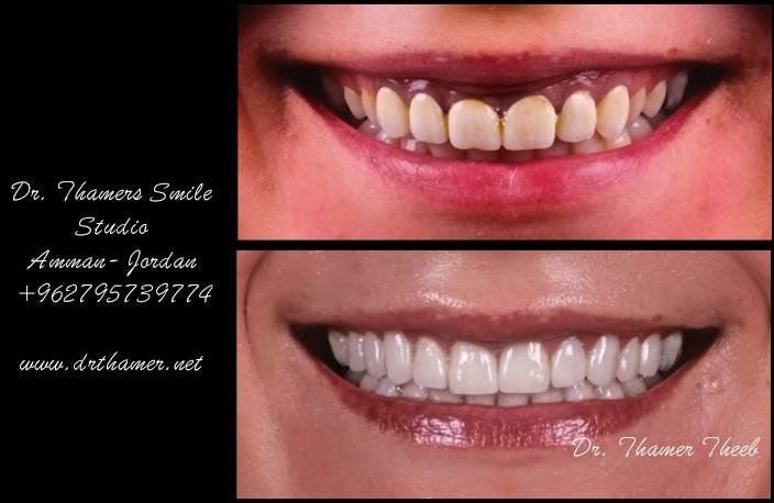 Dr. Thamer’s Smile Studio Dental Clinics - Dr. Thamer’s Smile Studio Dental Clinics