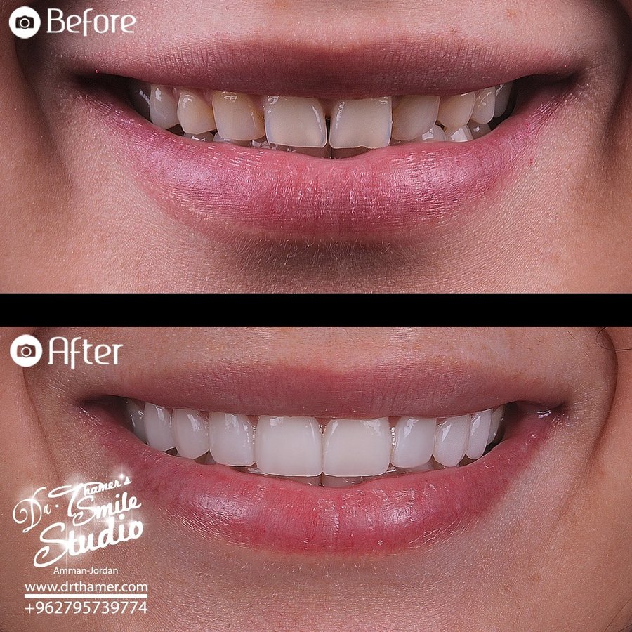 Dr. Thamer’s Smile Studio Dental Clinics - Dr. Thamer’s Smile Studio Dental Clinics