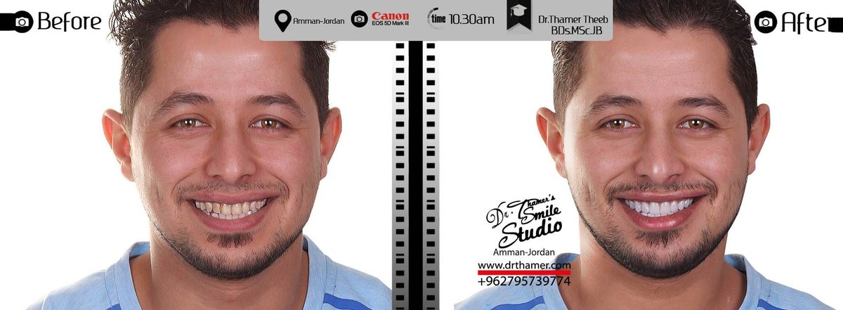 Dr. Thamer’s Smile Studio Dental Clinics - Dr. Thamer’s Smile Studio Dental Clinics